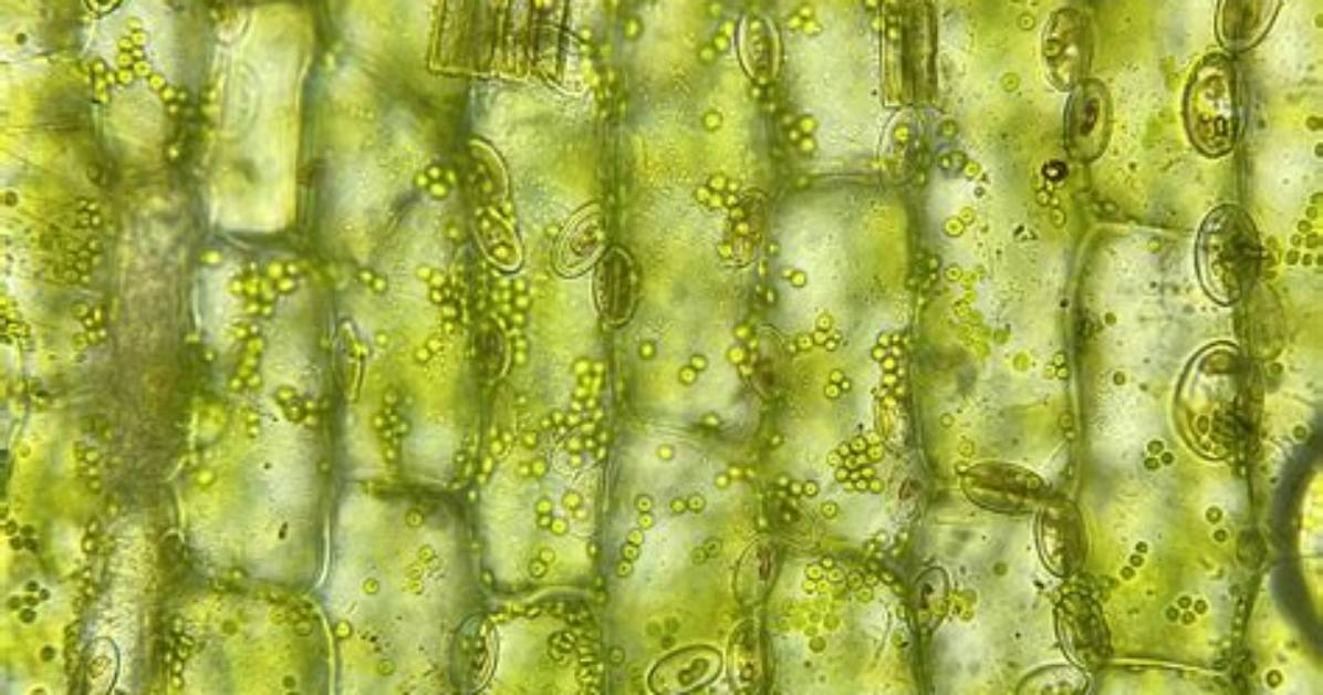 Is Elodea Cell Prokaryotic or Eukaryotic?