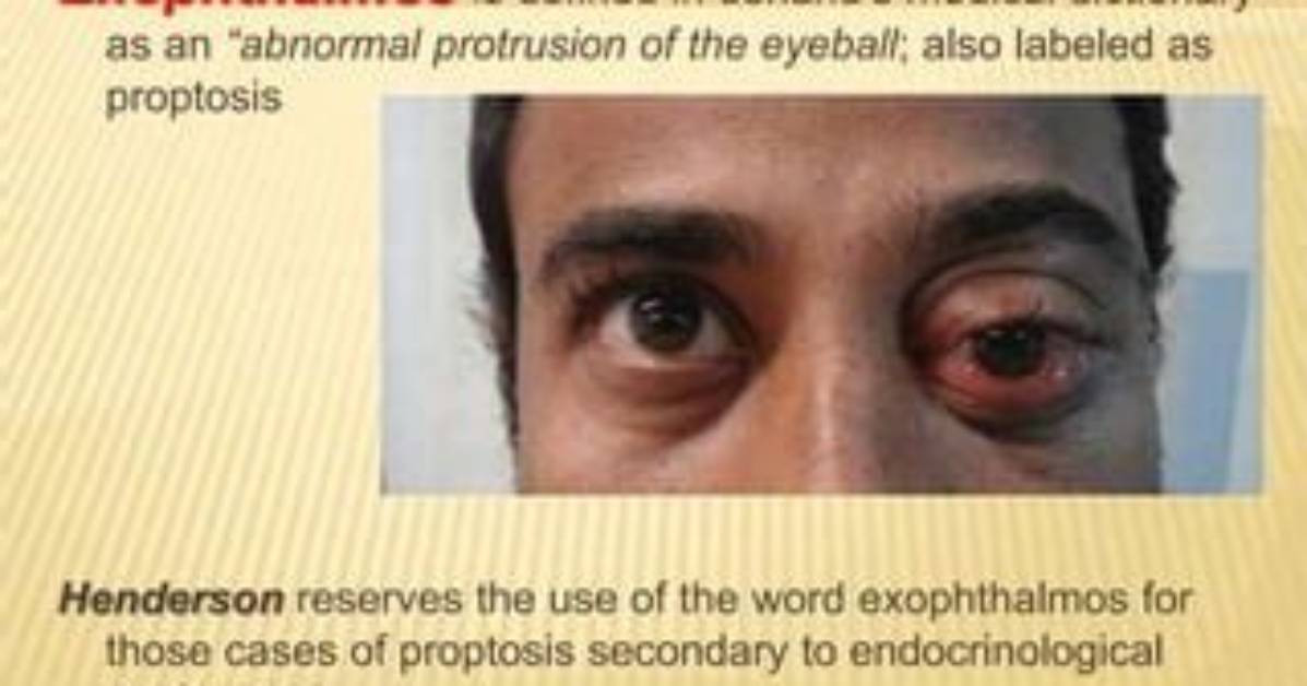 Is Endocrinological a Word?
