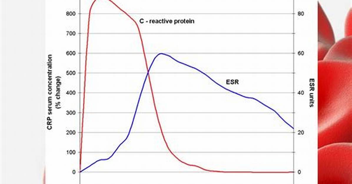 Is Esr the Same as Crp