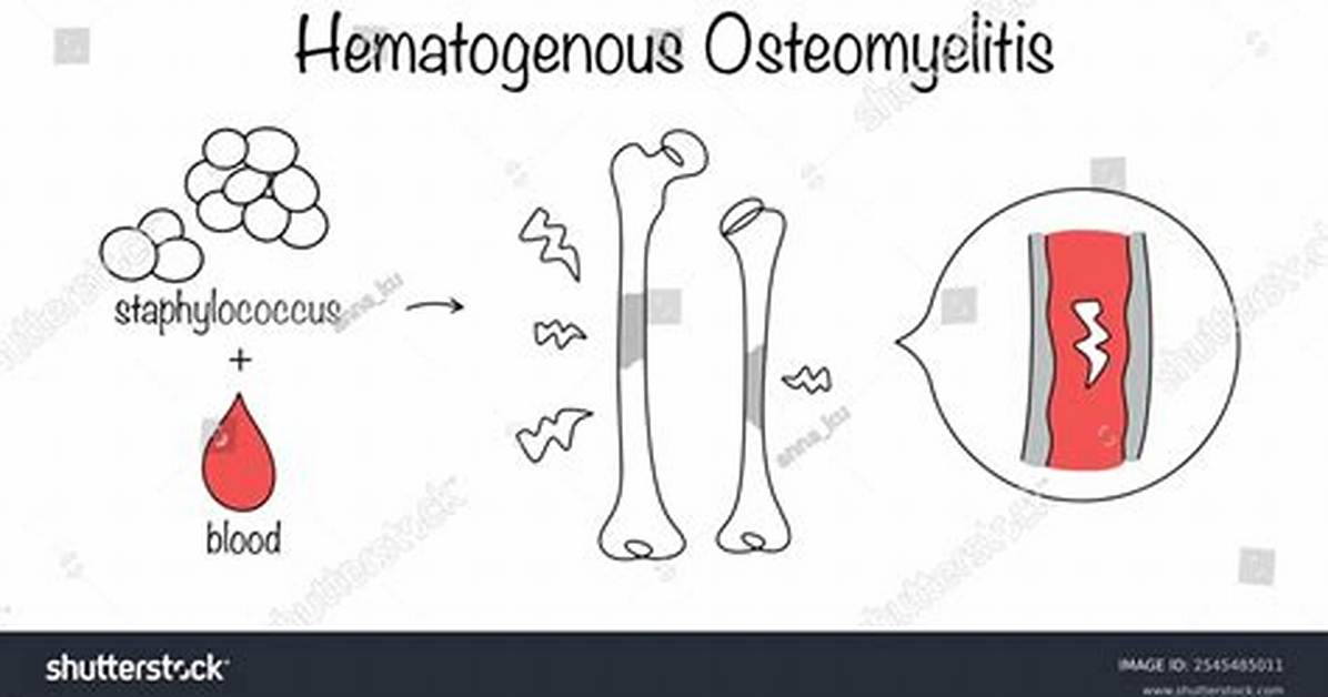 Is Hematogenous a Word?