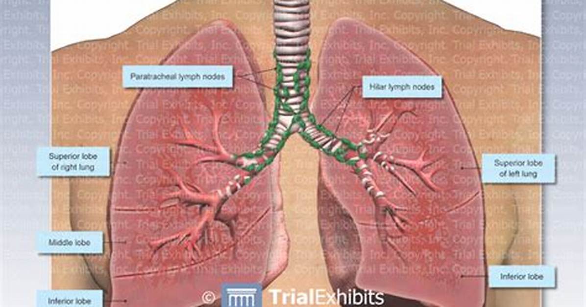 Is Hilar Lymph Nodes?