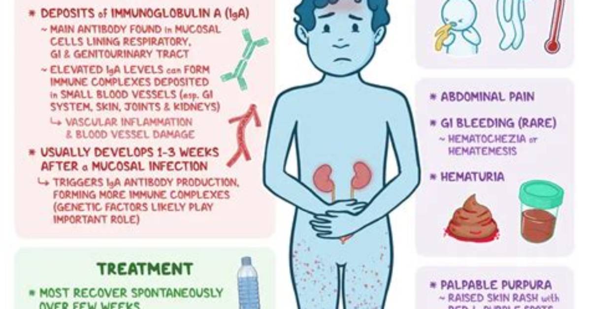 Is Hsp Disease Curable? | Contextresponse. Com
