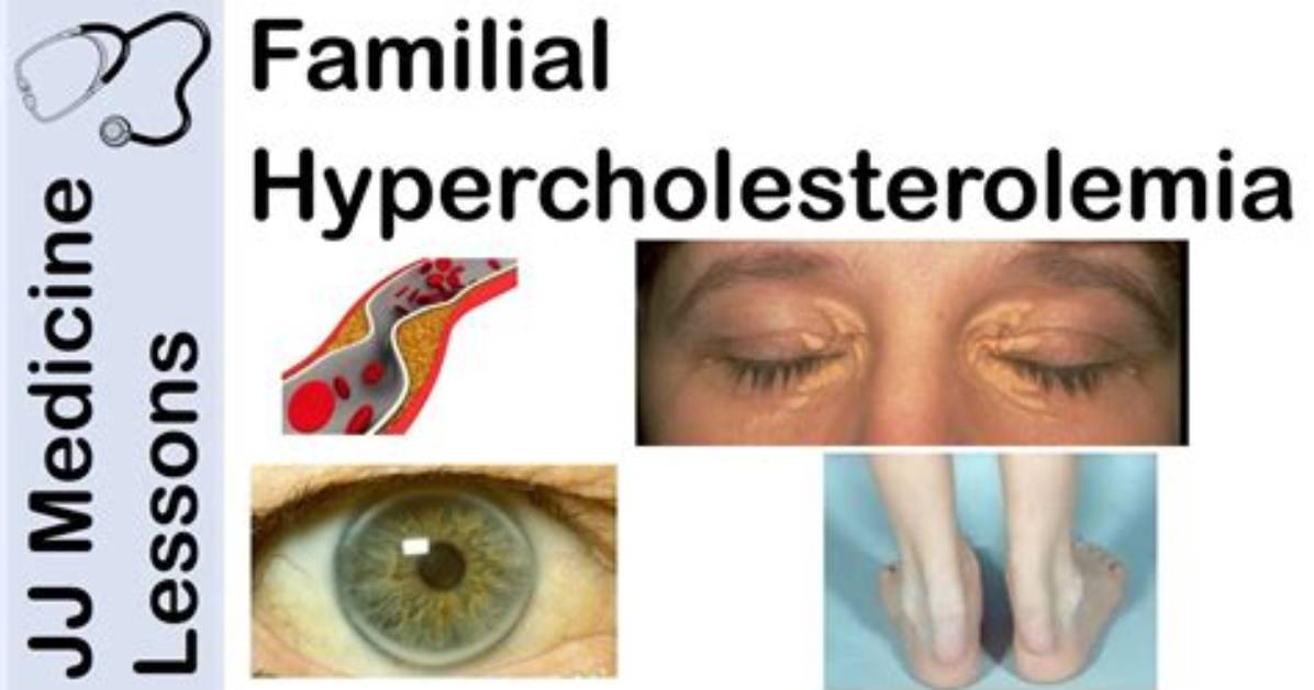 Is Hypercholesterolemia a Word?