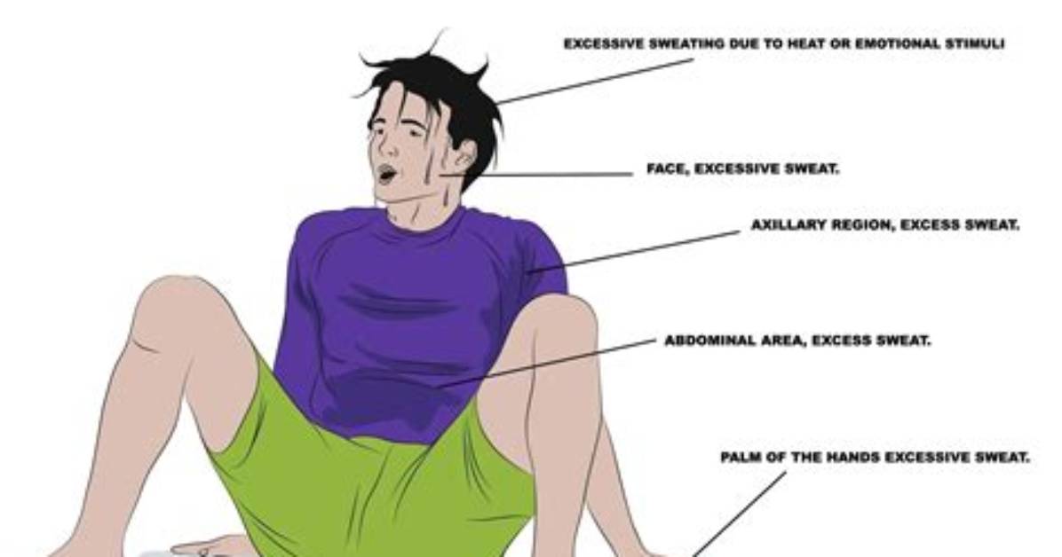Is Hyperhidrosis a Disability?