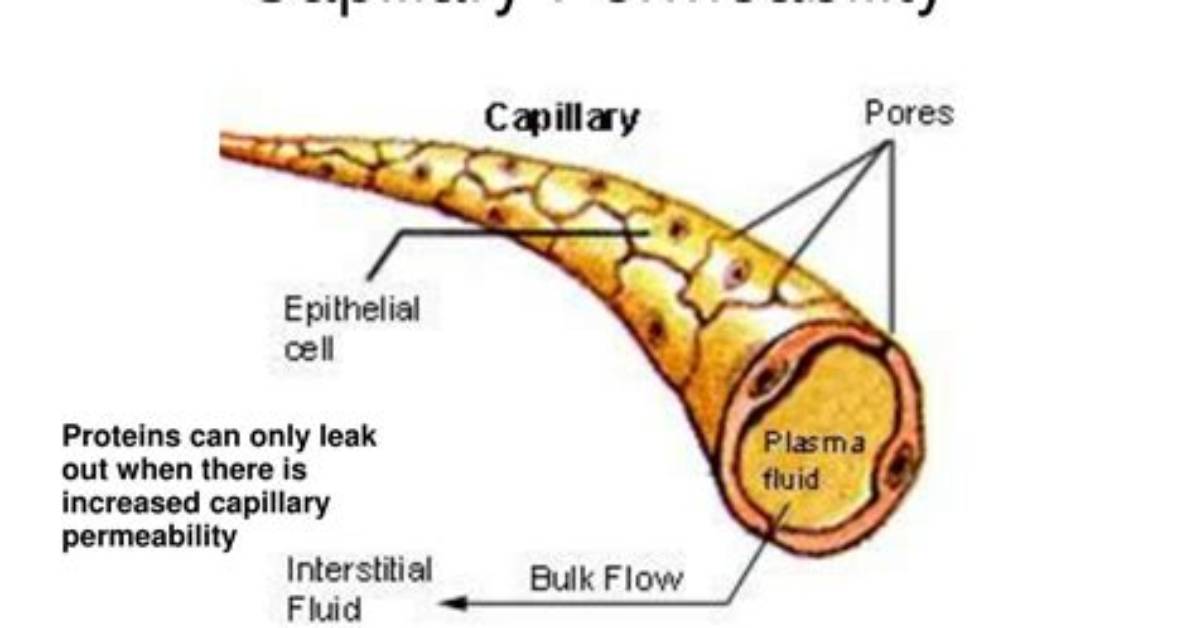 Is Increased Capillary Permeability?
