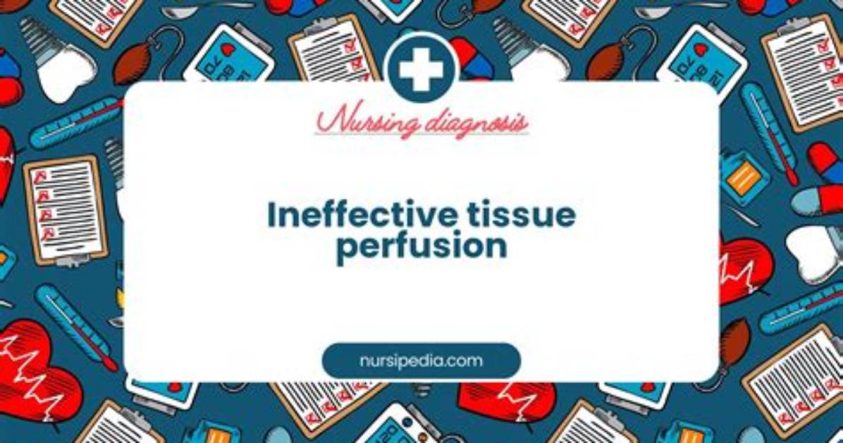 Is Ineffective Tissue Perfusion?