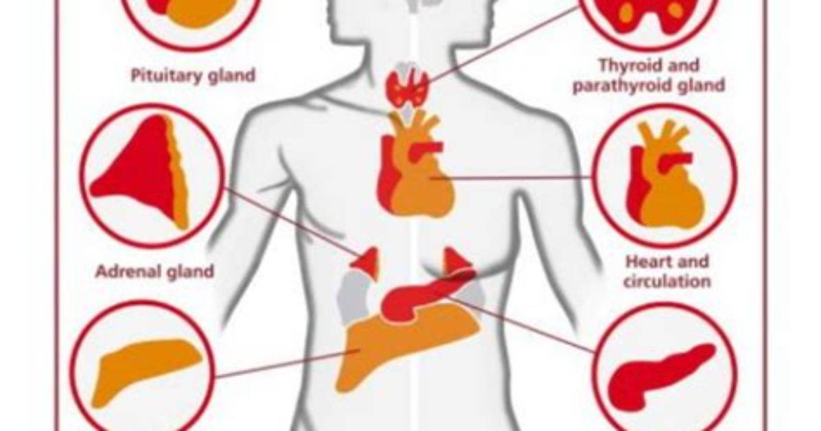 Is Iron Overload Dangerous?