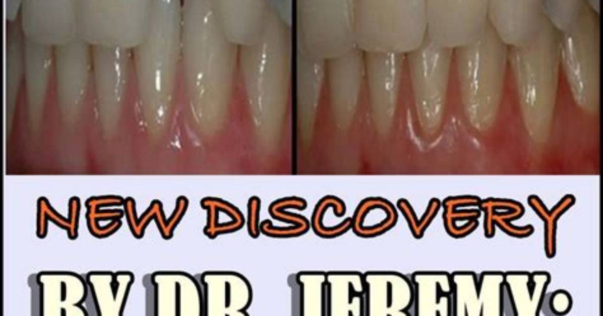 Is It Possible to Regrow Teeth?