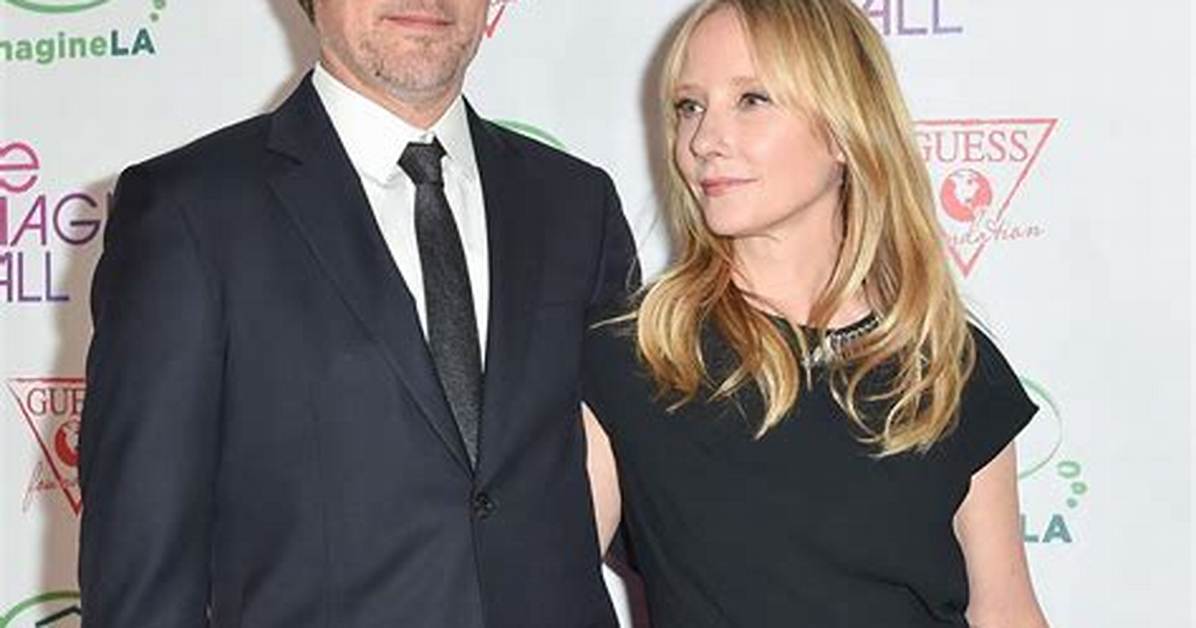 Is James Tupper Still Married to Anne Heche? – Celebrity