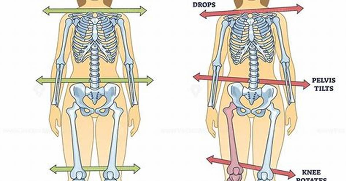 Is Leg Length Discrepancy a Disability?