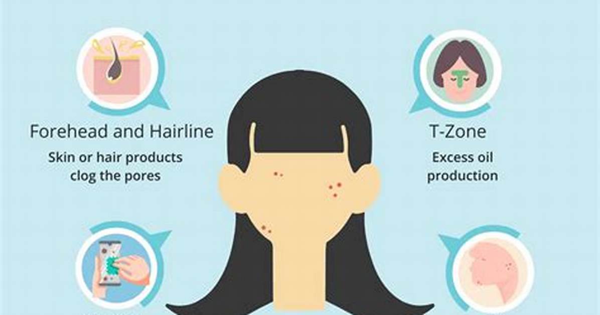 Is Meat Causing My Acne