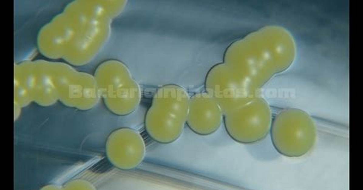 Is Micrococcus a Word?