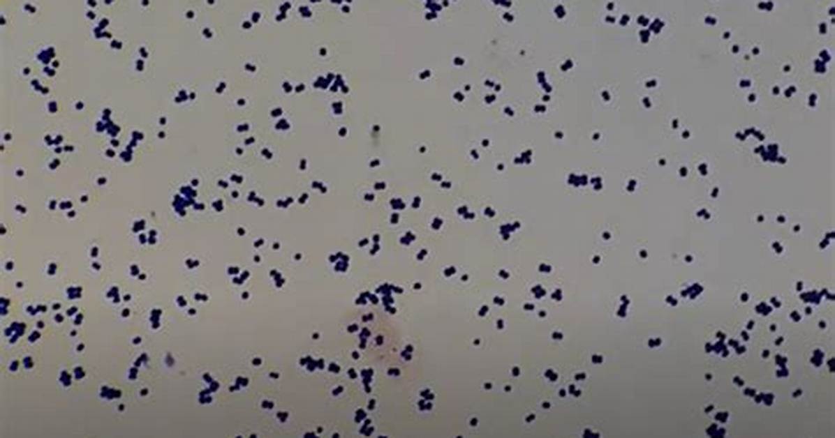 Is Micrococcus Luteus Gram Positive