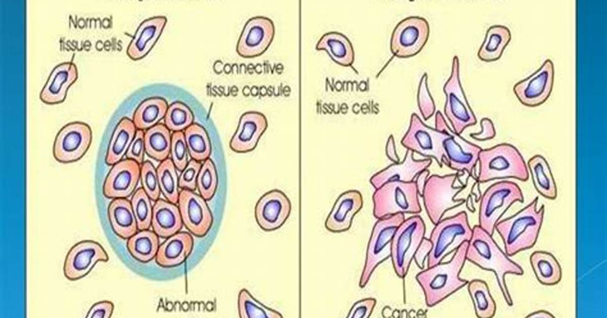Is Neoplasm Curable