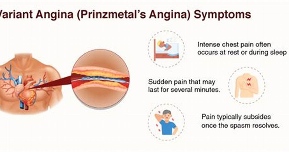 Is Prinzmetal Angina Unstable Angina