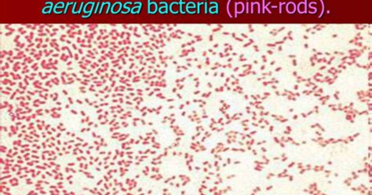 Is Pseudomonas Gram Negative?