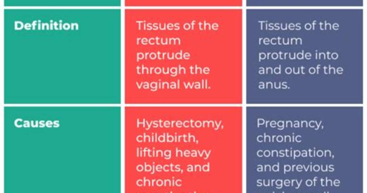 Is Rectocele the Same as Rectal Prolapse?