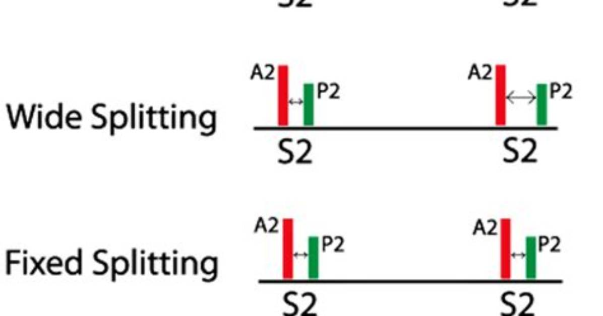 Is S2 Splitting Normal