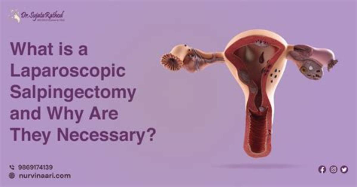 Is Salpingectomy a Sterilization?