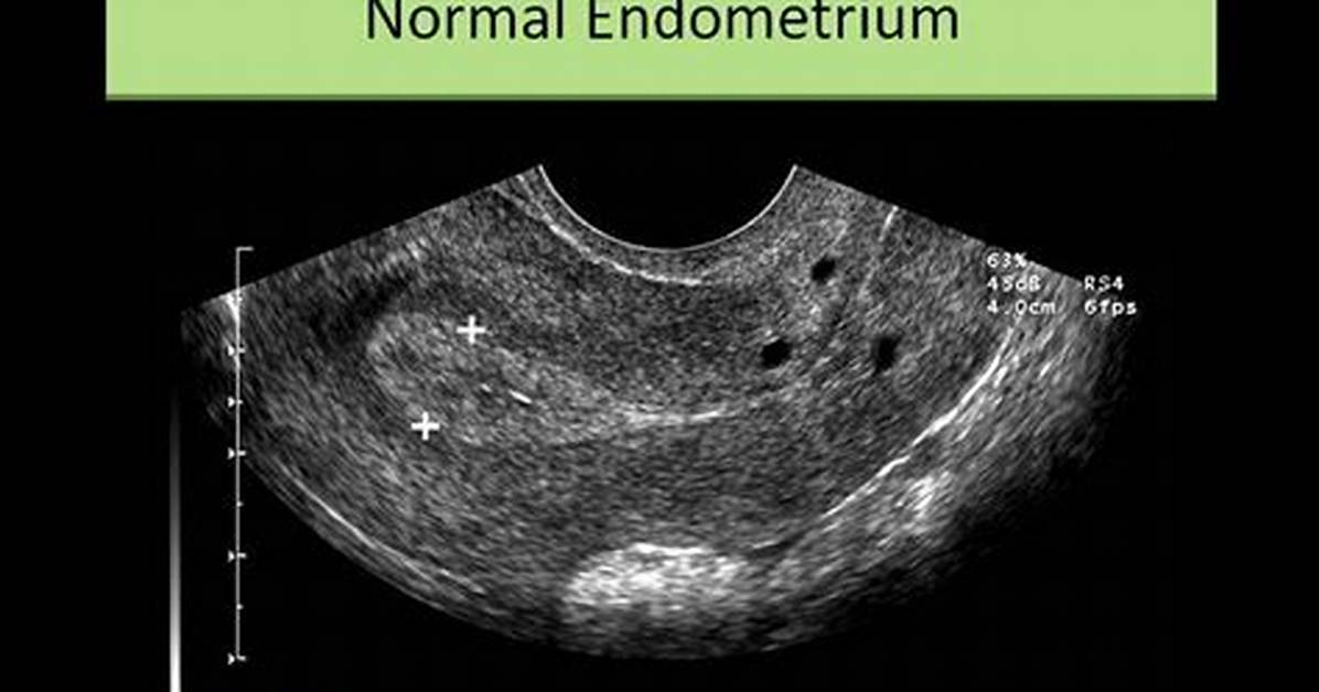 Is Secretory Endometrium Normal?