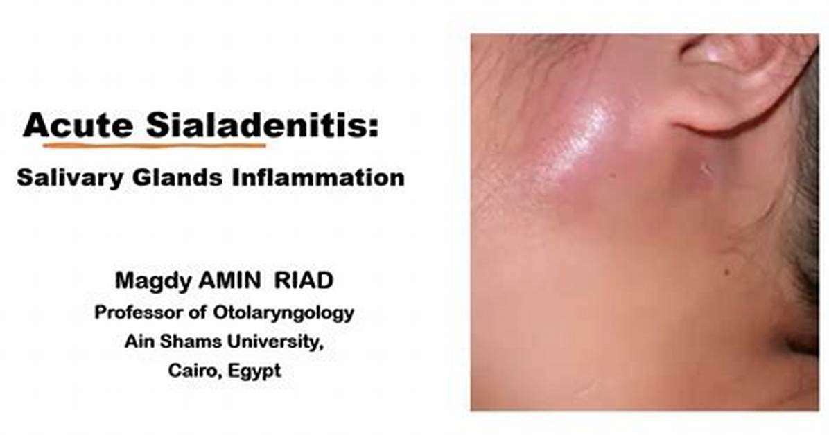 Is Sialadenitis Serious