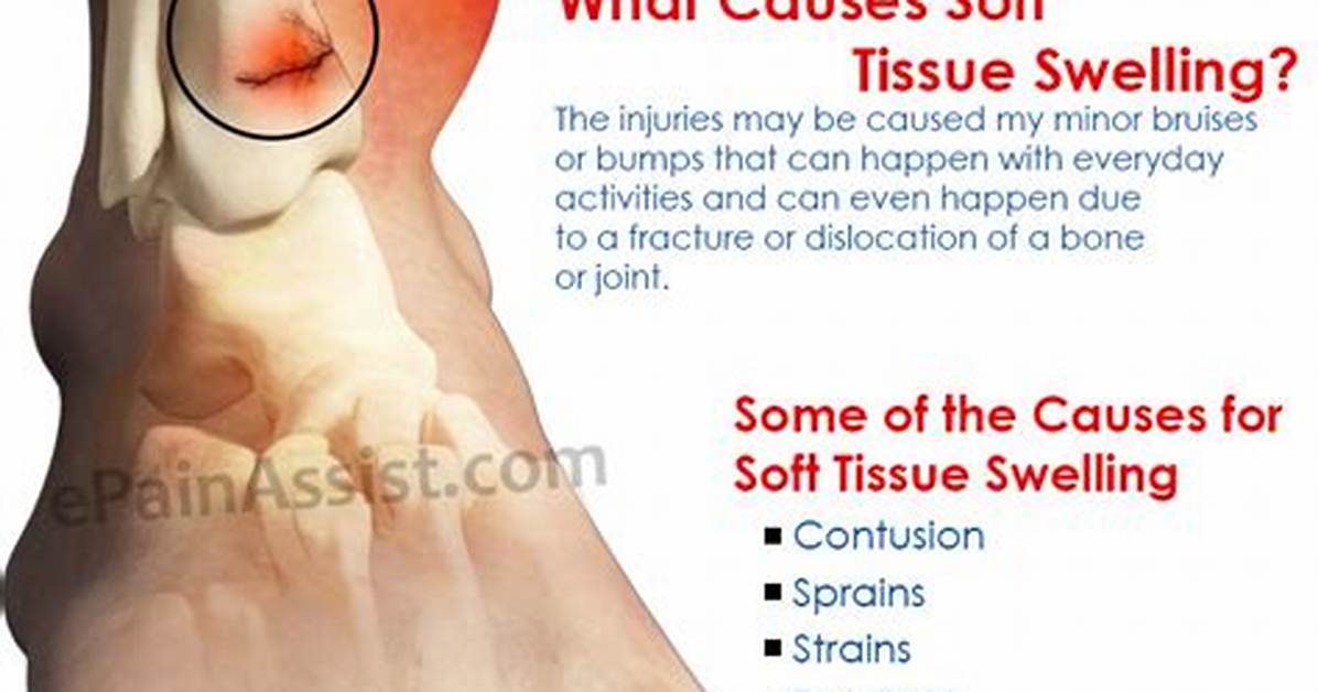Is Soft Tissue Swelling Bad?