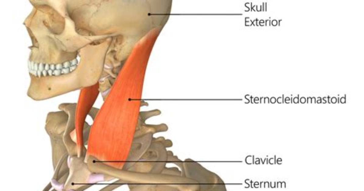 Is Sternocleidomastoid a Strap Muscle