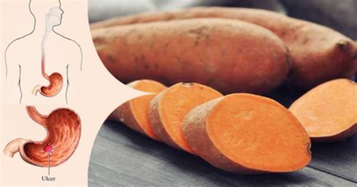 Is Sweet Potato Good for Stomach Ulcers?
