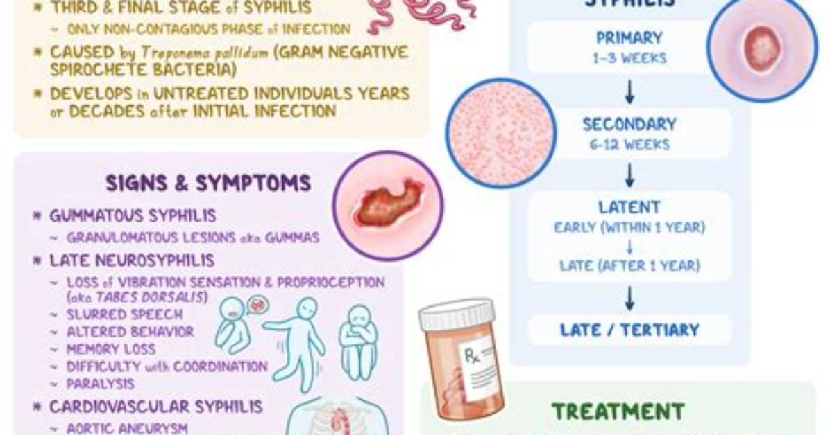 Is Tertiary Syphilis Contagious?