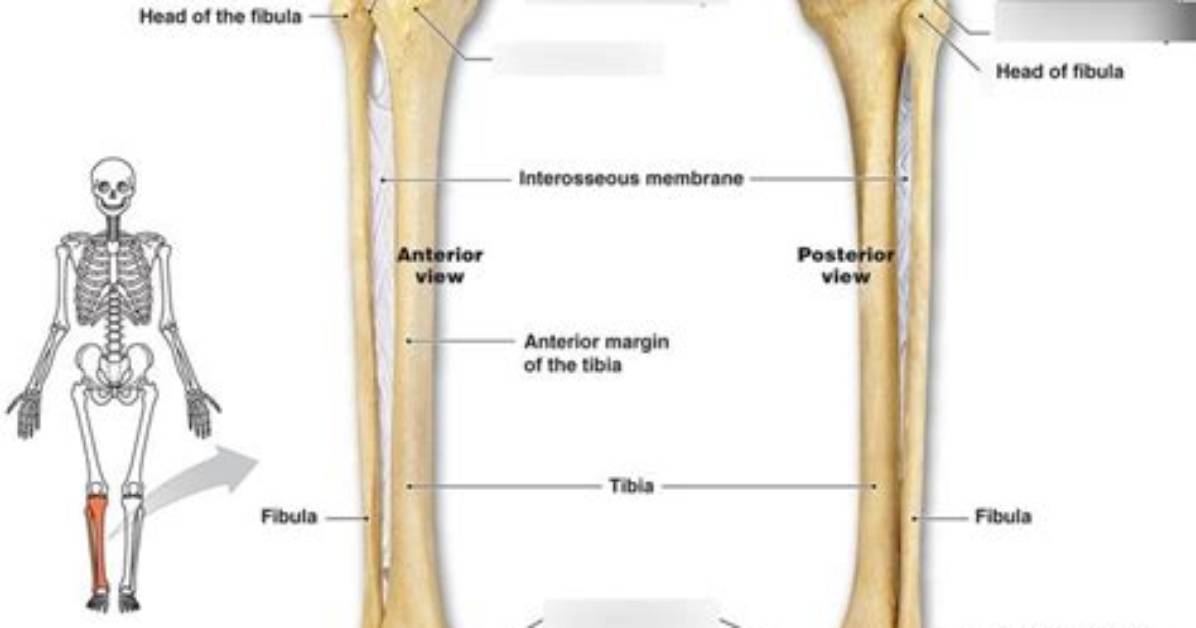 Is the Tibia Always Medial