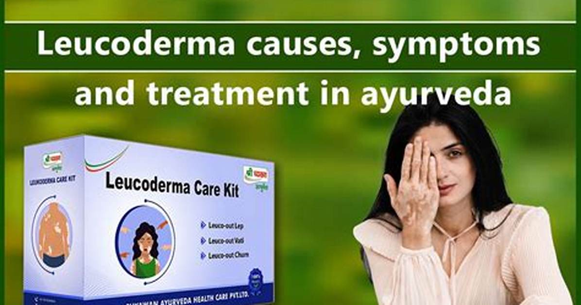 Is There a Cure for Leucoderma?