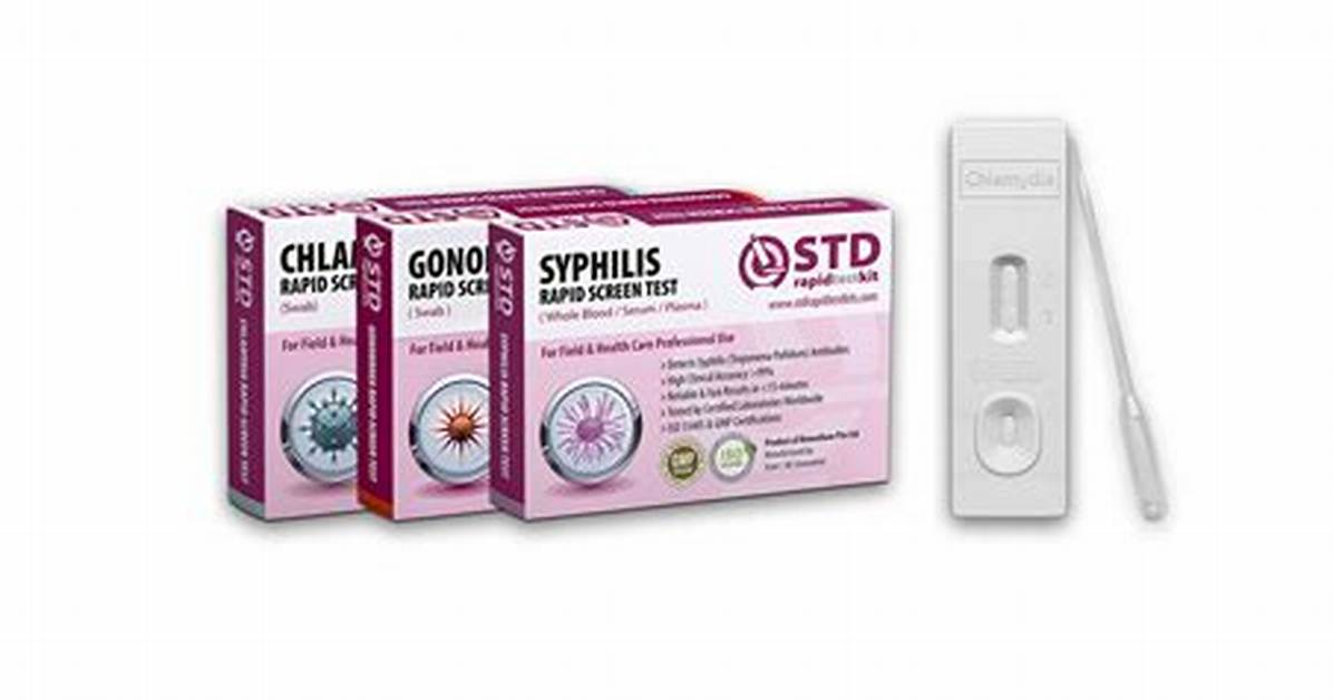 Is There a Test Kit for Bed Bugs