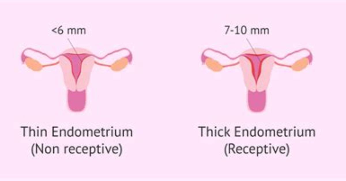 Is Thickened Endometrium Normal?