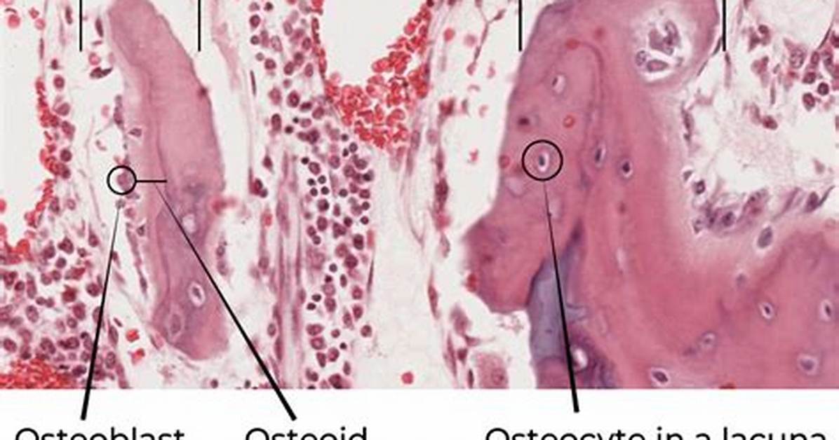 Is Trabeculae a Spongy Bone