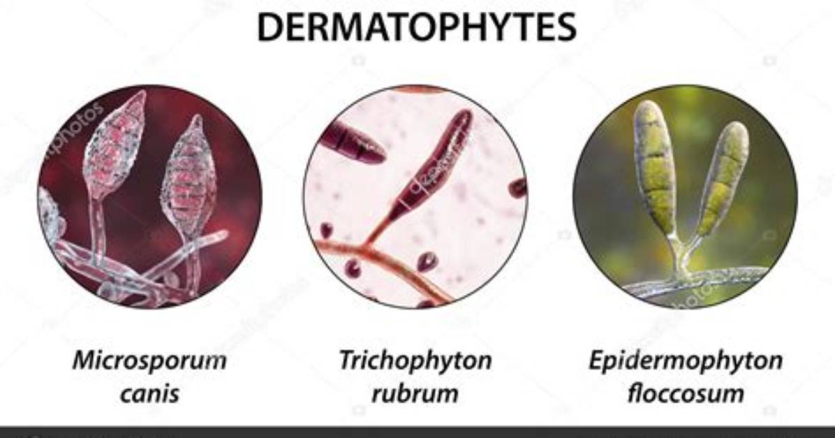 Is Trichophyton a Dermatophyte?