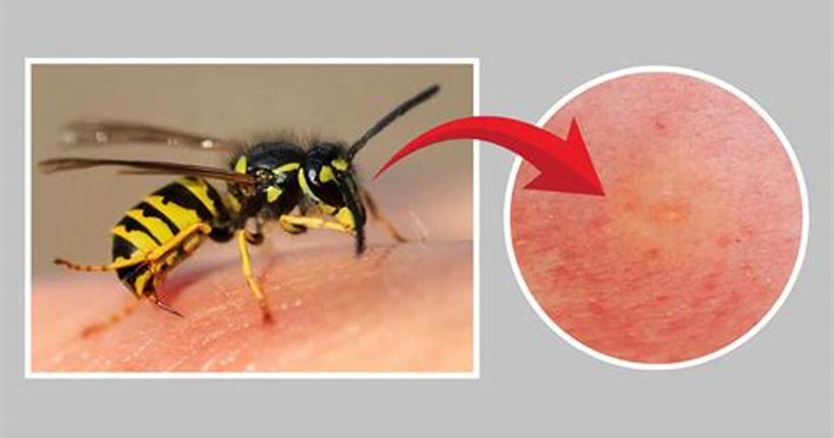 Is Wasp Sting Dangerous?