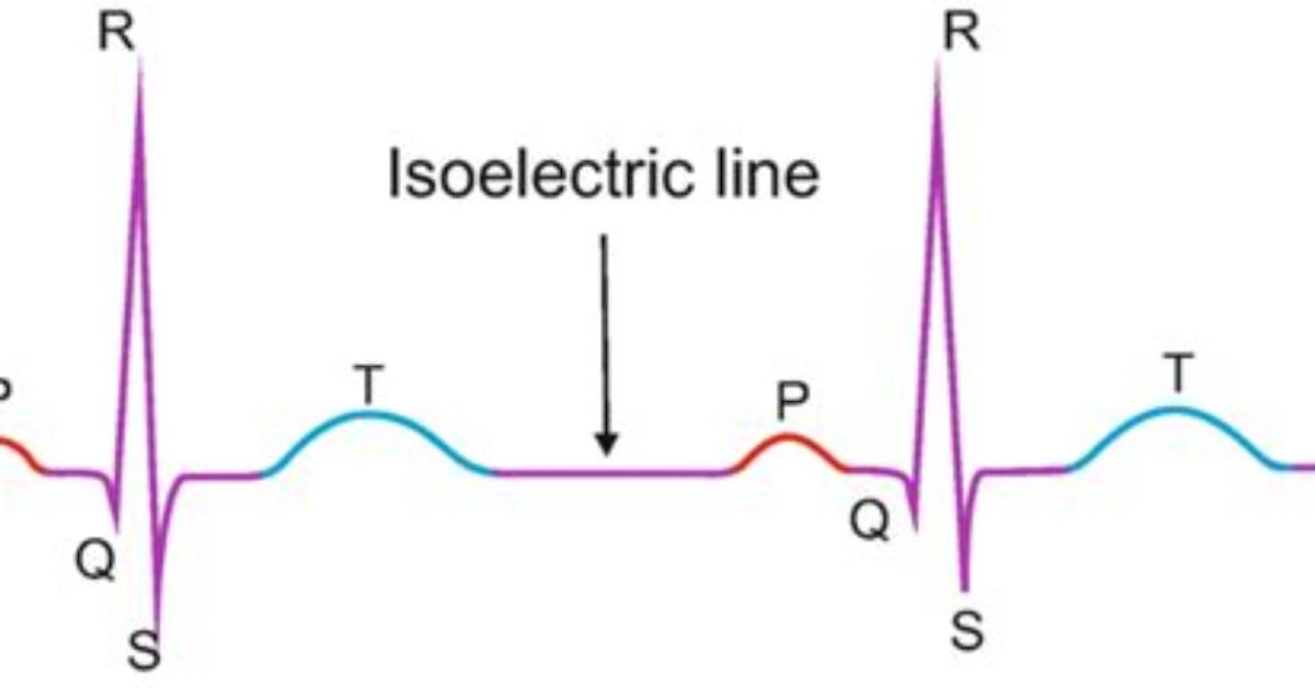 Isoelectric Line