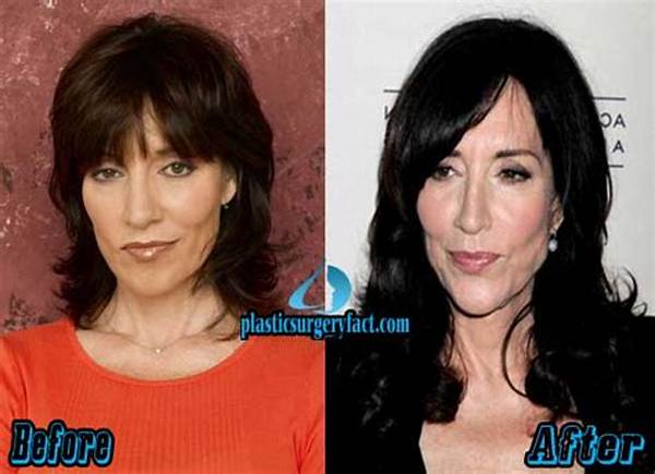 Katey Sagal Facelift Plastic Surgery Before and After