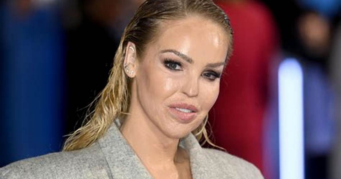 Katie Piper