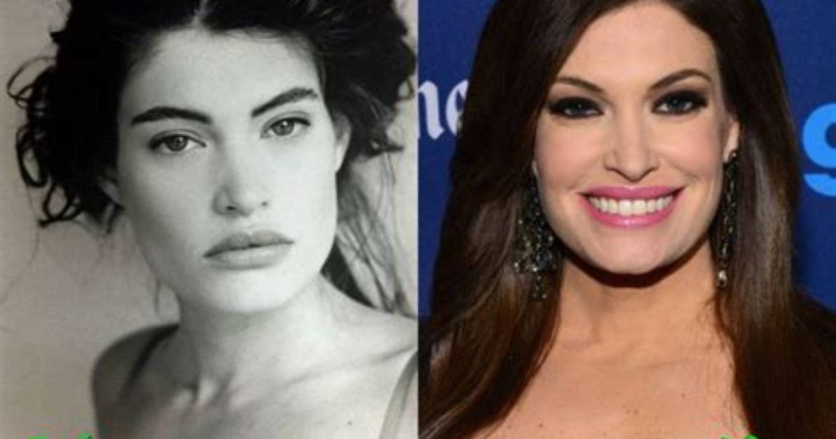 Kimberly Guilfoyle Plastic Surgery: Before & After!