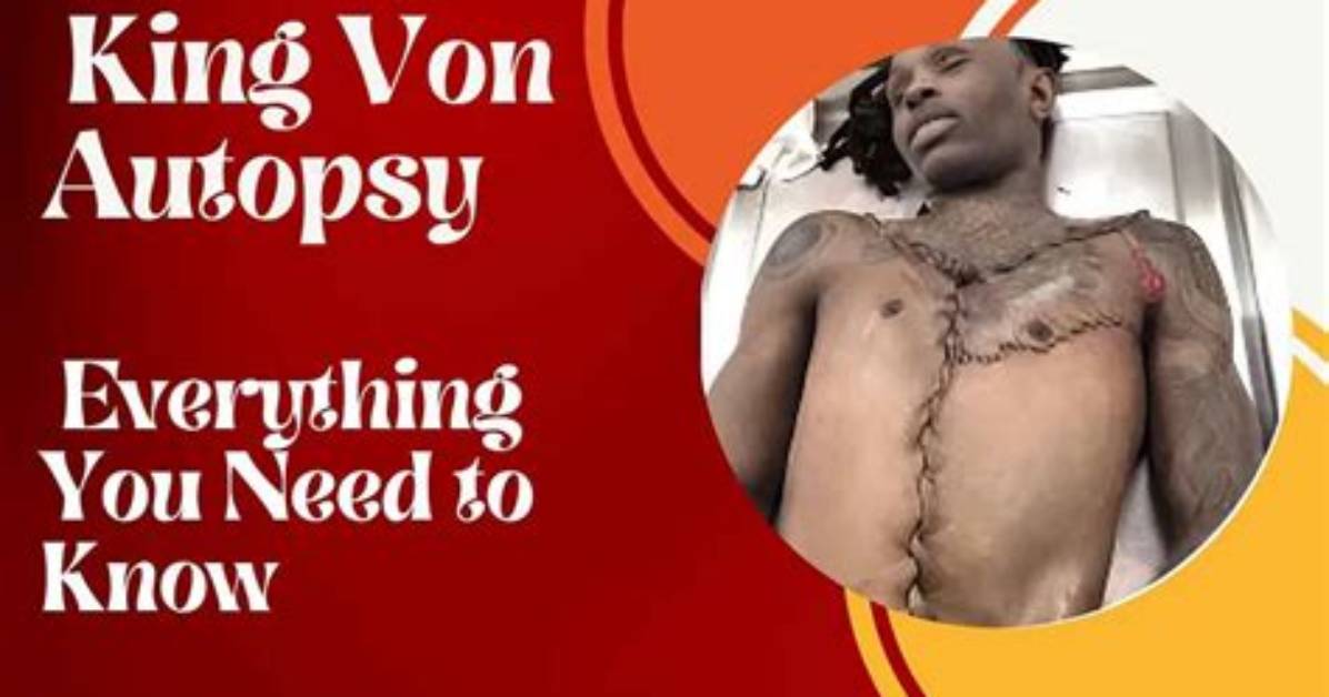 King Von Autopsy Results: Understanding the Truth Behind His Tragic Death