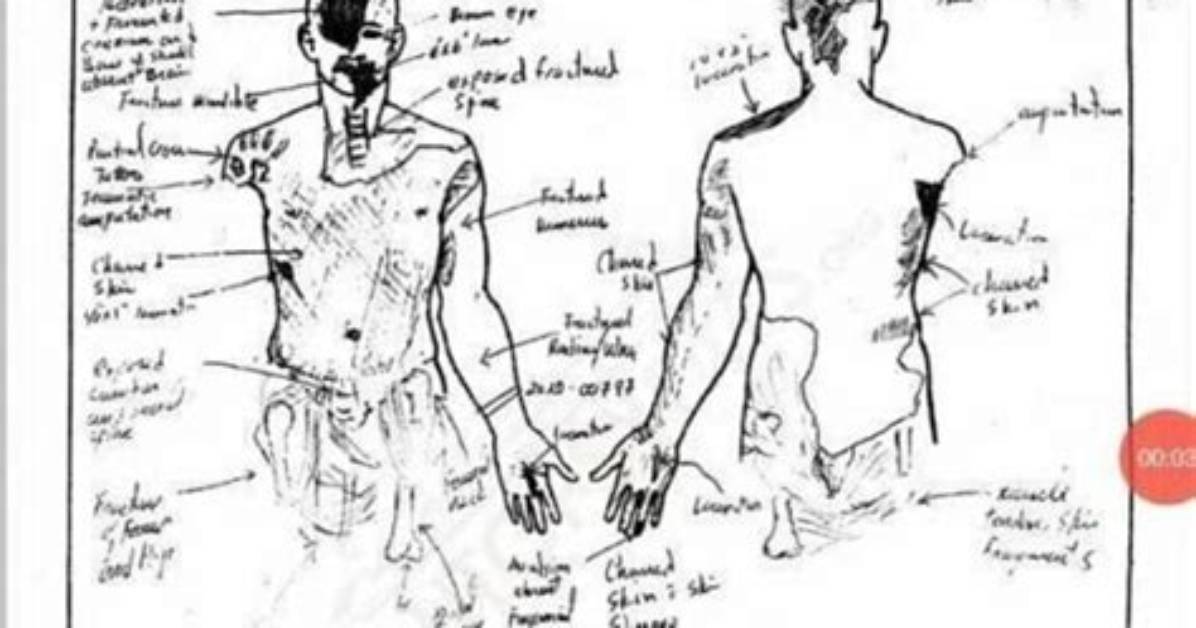 Kobe Bryant Autopsy Report Drawing: Kobe and Gigi’s Tragic Death