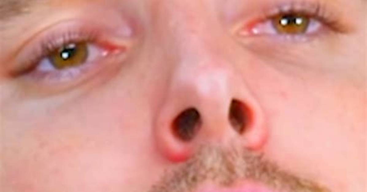 Lazarbeam