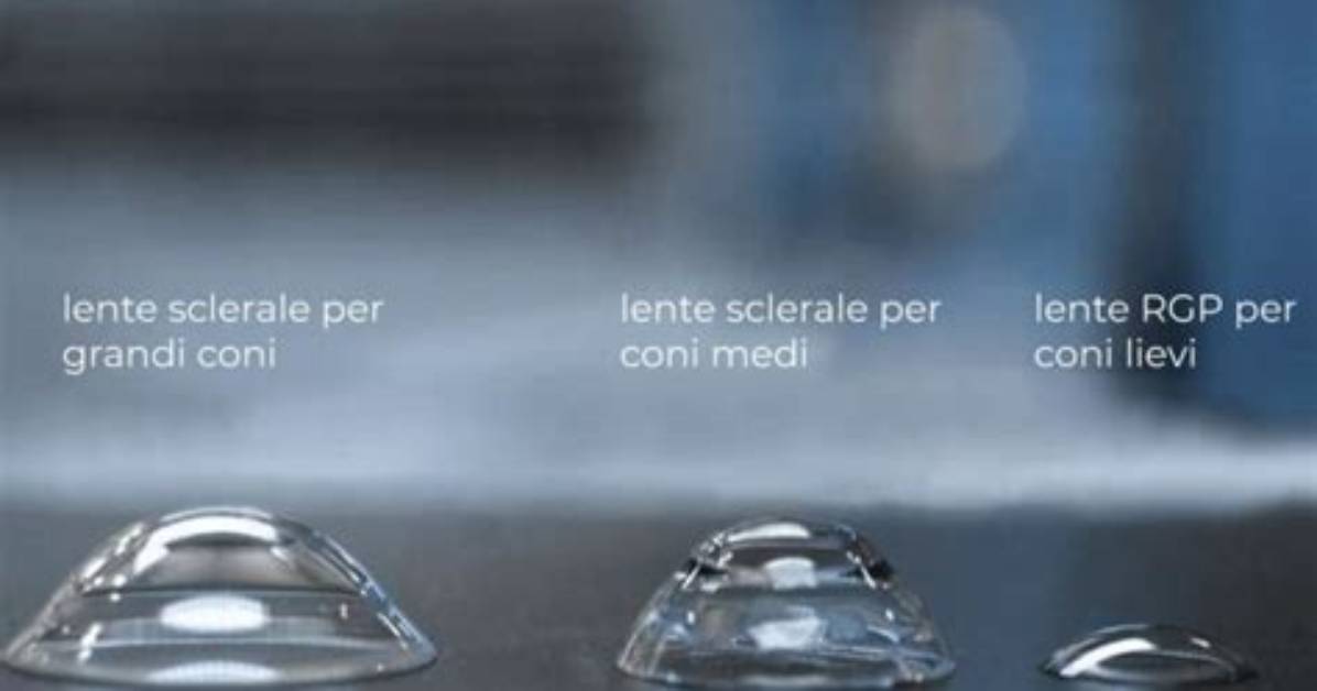 Lenti a Contatto Rigide E Morbide: Come Funzionano?