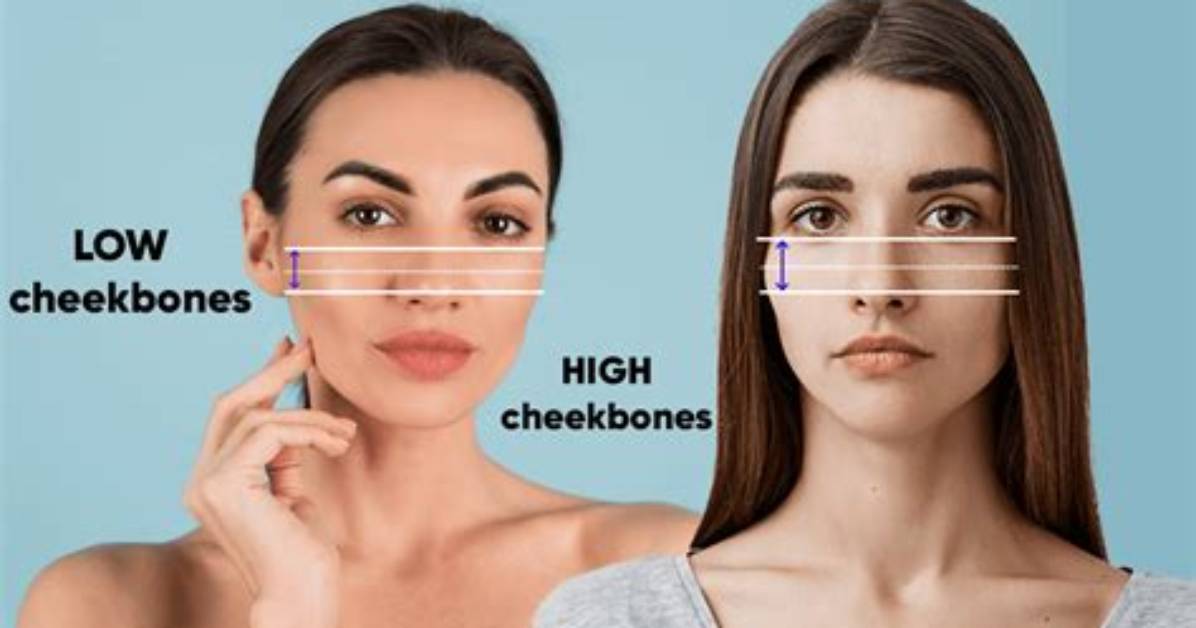 Low Cheekbones - How to Discuss