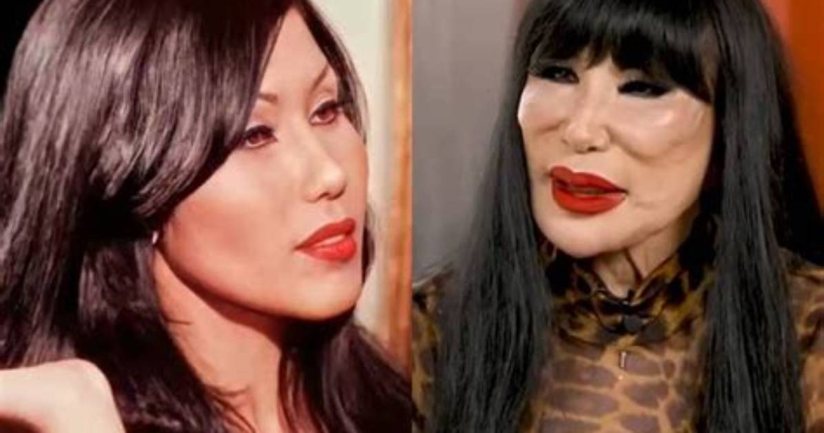 Lyn May Face Incident: a Deep Dive into Her Life and Career