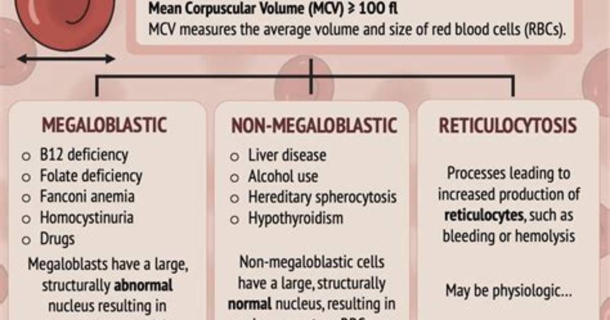 Macrocytic Normochromic Anemia