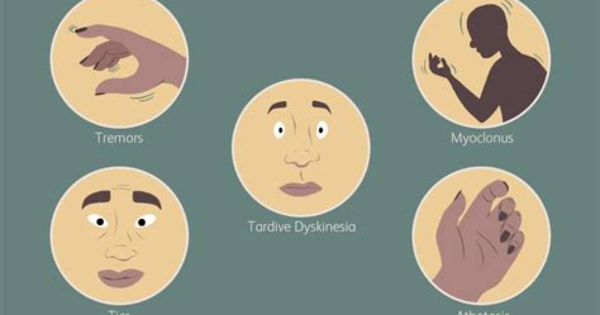 Medical Term for Involuntary Movement, Check These out | What Are Involuntary Movements Called?