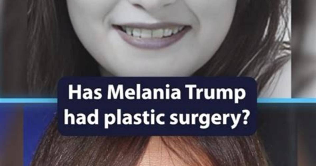 Melania Trump Breaks Silence on Plastic Surgery Rumors and It Confirms What We Suspected