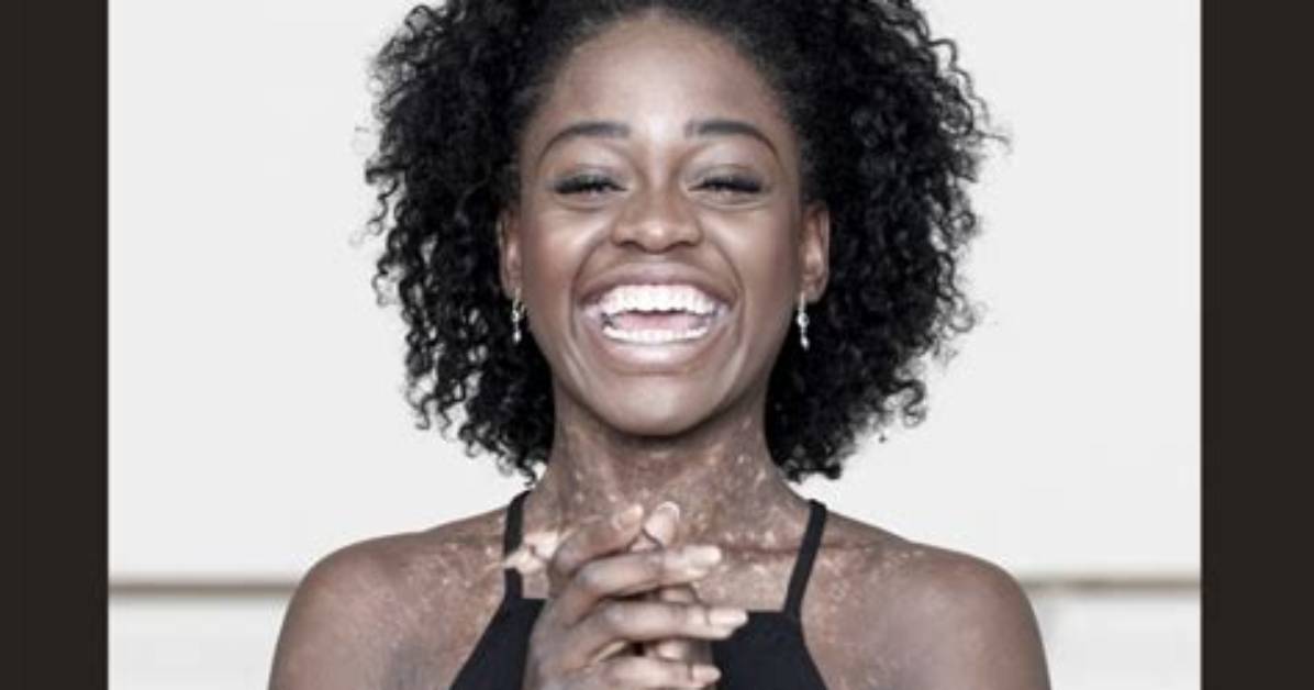 Michaela Deprince Net Worth
